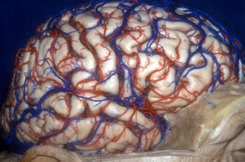 Neuralink
