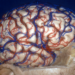 Neuralink Neuralink