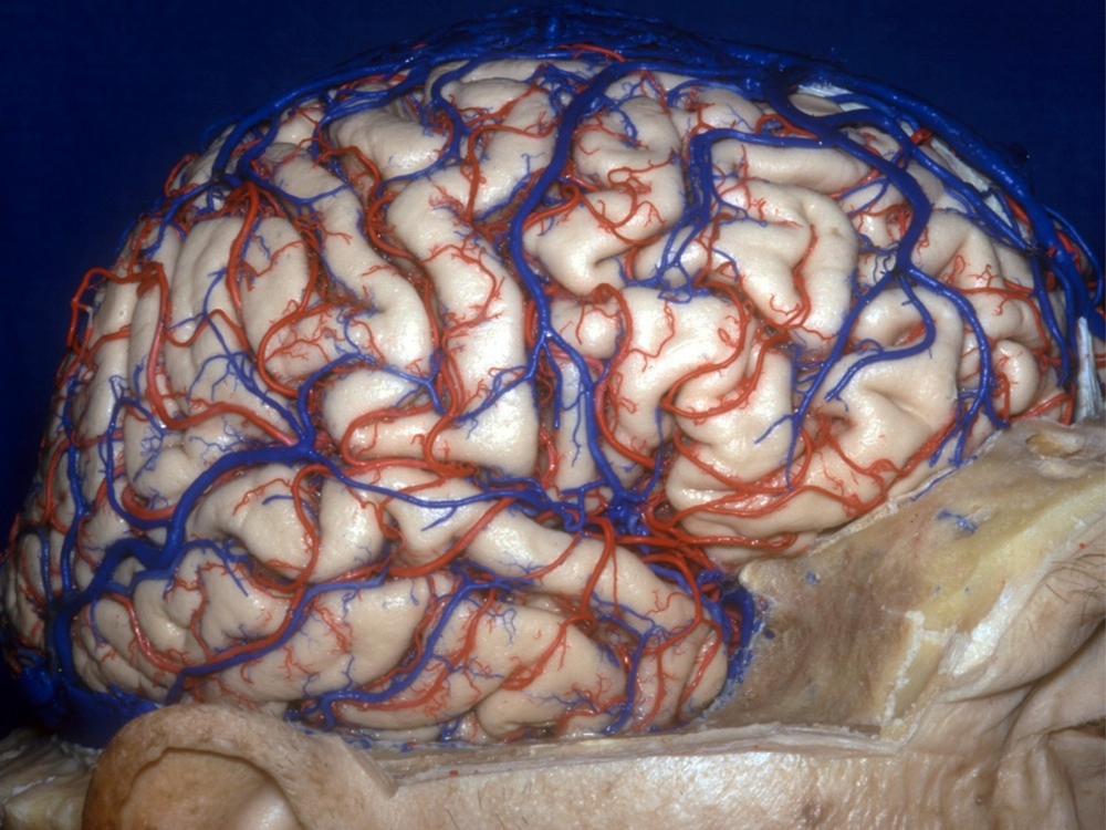 Neuralink Neuralink
